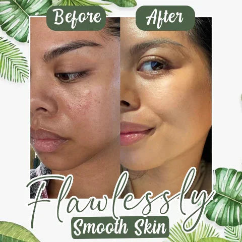 Green Mask Stick Black Head & Acne Remover - 100% Original